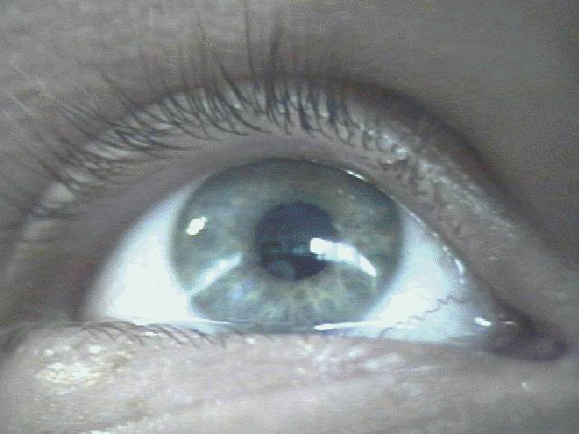 View into Francis's eye